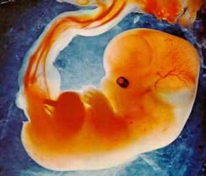 fetus-jpeg